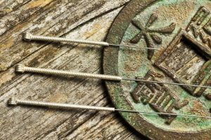 16555586_l-1080×675 16555586_l-1080×675